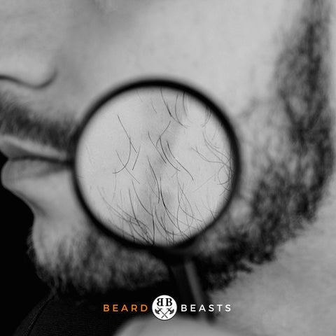 Beard Hair Loss: Causes, Symptoms, and Effective Solutions - Beard Beasts