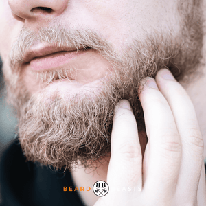 Articles featured image of a man with sores under his beard