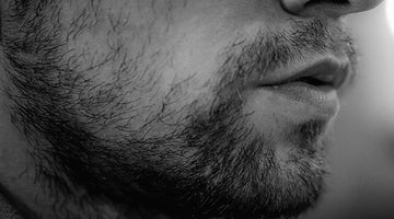 Beard Bald Spot: Understanding and Addressing Facial Hair Bald Spots - Beard Beasts