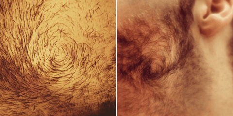 Beard Cowlick: Causes, Management and Styling - Beard Beasts