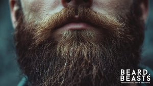 Close-up of a man's beard with visible white flakes, illustrating beard dandruff and the need for proper care techniques on how to get rid of beard dandruff effectively.