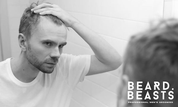 Concerned man examining thinning hair and receding hairline in bathroom mirror, early signs of male pattern baldness.